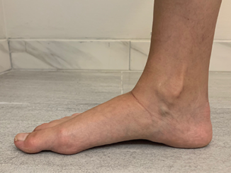 woman's-foot