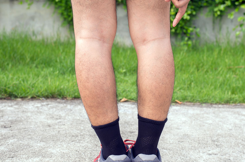 Asian man leg bandy-legged shape of the legs