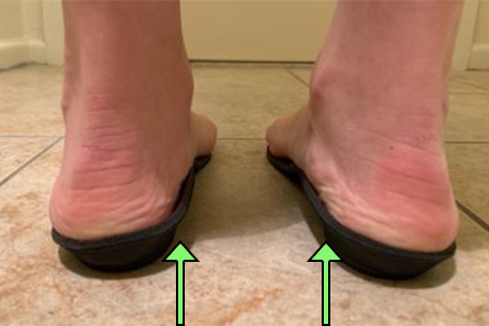 orthotics-for-women-with-foot-pain