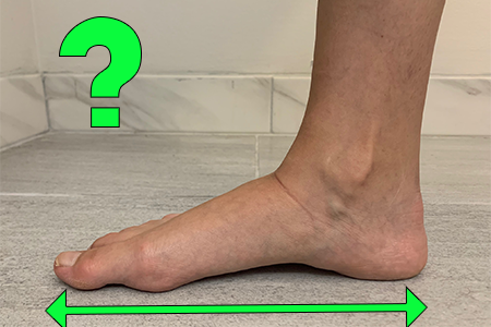 does-my-foot-shape-changes-over-time