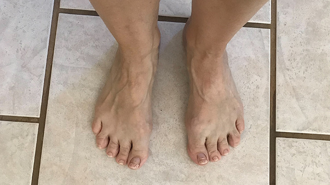 Woman with Extra Wide Feet